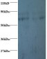PFDN5 / MM1 Antibody